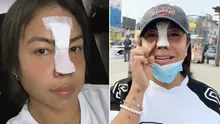 Dayanita explica por qué se operó la nariz tras polémica por quemar cráneo humano: "No podía respirar bien"