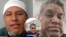 Peruano denuncia agresión xenófoba en Chile y paramédicos se niegan a atenderlo: "Me han roto la cabeza"