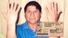 El curioso caso de Donato Cervantes, el peruano que iba a ser amputado del brazo, pero afirmó haber sido curado por extraterrestres El curioso caso de Donato Cervantes, el peruano que iba a ser amputado del brazo, pero afirmó haber sido curado por extraterrestres