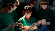 Hospital Loayza realiza exitosa cirugía de craneotomía con paciente despierta