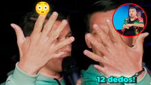 Peruano sorprende al revelar en show de Hablando Huevadas que tiene 6 dedos en cada mano y pies: “Es un X-Men”