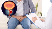 Avances en el diagnóstico y tratamiento del cáncer de próstata: innovaciones clave para mejorar las tasas de éxito