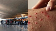 Funcionario de salud de Washington alerta sobre caso de un viajero con sarampión en aeropuerto de Dulles Funcionario de salud de Washington alerta sobre caso de un viajero con sarampión en aeropuerto de Dulles