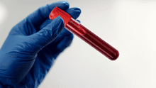Científicos ponen a prueba sangre artificial en humanos compatible con cualquier grupo sanguíneo, según estudio en Japón