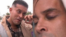 Christian Domínguez sorprende al reaparecer con el ojo morado tras ausentarse de su programa: “Jugué muy fuerte”