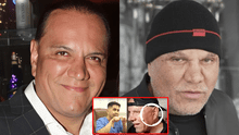 Mauricio Diez Canseco luce radical cambio facial tras someterse a retoques estéticos y Magaly reacciona: "Es otro"