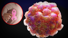 Científicos españoles identifican la proteína que ayuda a las células cancerosas a expandirse a otros órganos: "Son capaces de evadir el sistema inmune"
