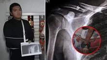 Golpean brutalmente a campeón de marinera en partido de fútbol tras pedir que "jueguen tranquilos", en Callao
