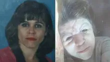 El trágico caso de una mujer que creyó que le inyectaban vitamina C y terminó siendo una sustancia prohibida: "Acabó con mi rostro"
