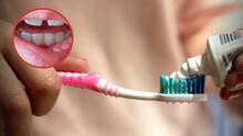 ¿Qué es el fluoruro de estaño y por qué el Digemid lo calificó de riesgoso? Está presente en la pasta Colgate Total Clean Mint y en 13 cremas más