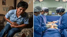 ¿Por qué los peruanos dicen que el apéndice no sirve? Especialista explica el motivo para extraer este órgano y cómo es la operación