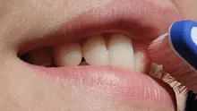 Científicos descubren una nueva solución para reparar los dientes dañados al usar un ingrediente peculiar