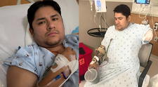 Inmigrante mexicano pierde el brazo al escapar del ICE cuando regresaba de trabajar en California: "Pensaron que estaba muerto"