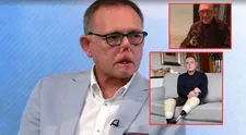 El trágico caso de Jaco Nel, el hombre que perdió piernas, dedos y parte de su cara por lamida y arañazo de su perro