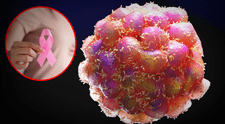 Científicos españoles identifican la proteína que ayuda a las células cancerosas a expandirse a otros órganos: "Son capaces de evadir el sistema inmune"