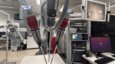 Con entrenamientos de videos y ChatGPT, un robot marca hito en la medicina al extirpar una vesícula sin ayuda humana