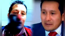 Empresario abatió en defensa propia a sujeto que lo golpeó y le robó S/9.000, pero podría ir preso 15 años: "Era mi vida o la del delincuente"