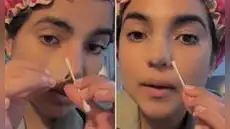 Susana Alvarado de Corazón Serrano muestra cómo luce su renovada nariz y enseña paso a paso su cuidado postoperatorio: "Va excelente"