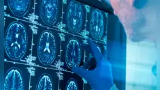 No es en la adolescencia: científicos revelan la edad en que el cerebro llega a la madurez y cuándo empieza a envejecer