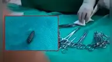 Larvas de mosca caen del techo durante cirugías en el Hospital Materno Infantil de Huancayo y desatan alarma sanitaria Larvas de mosca caen del techo durante cirugías en el Hospital Materno Infantil de Huancayo y desatan alarma sanitaria