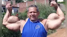 Fallece a los 55 años el ‘Popeye brasileño’, que se hizo famoso por someterse a tratamientos con aceite en los brazos para parecerse al personaje