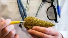 Científicos curan el cáncer de páncreas en ratones: ¿podría llegar a probarse el tratamiento en humanos?