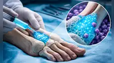 Científicos suizos crean un nuevo hidrogel que podría ser clave para reparar las graves fracturas óseas en corto tiempo