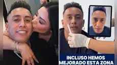Christian Cueva sorprende al someterse a tratamiento de masculinización y muestra resultados en su rostro
