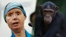La historia de Charla Nash, la mujer que sobrevivió al ataque del chimpancé Travis en EE. UU.: enfrentó años de reconstrucción facial