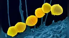 Una momia prehispánica revela que la bacteria de la faringitis ya existía en América antes de la llegada de los europeos