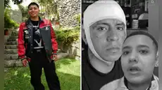 Streamer Ángel Ramírez sufre golpiza en discoteca y termina herido tras corte en la frente