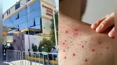 Sarampión se extiende en Perú: Arequipa confirma caso importado y refuerza prevención en colegios y terminales