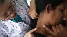 Alerta por cáncer de piel: 200 peruanos son derivados por sospecha de melanoma y Junín lidera casos