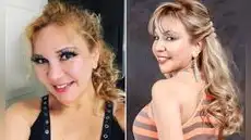 Mónica Adaro sufre grave accidente en EE. UU. y espera volver a caminar en seis meses: “Pasé por el túnel y vi la luz”