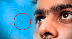 ¿Por qué sueles ver ‘gusanitos’ en tu campo visual? Esto dice la ciencia