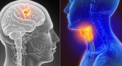 Nuevo tratamiento destruye tumores del cáncer de cabeza y cuello, según estudio 
