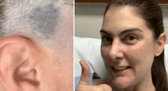 Fue a cortarse el cabello y su estilista notó algo que le salvó la vida: “Realmente me asustó”