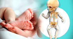 ¿Por qué los bebés al nacer tienen más huesos que los adultos?