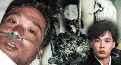 ¿Cómo fue el final de Hisashi Ouchi, el hombre que sufrió la mayor carga radioactiva de la historia?