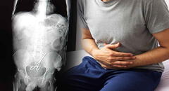 Hombre acude al hospital por dolor abdominal y encuentran tijeras quirúrgicas en su intestino