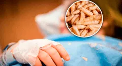 Niña de 4 años fue llevada al hospital y le extrajeron más de 100 gusanos de su cabeza