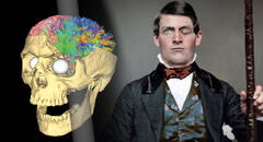 Phineas Gage: el hombre que vivió 12 años con un hueco en el cráneo por una varilla de metal