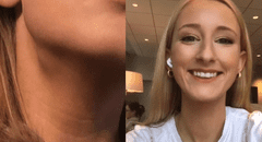 Joven descubre que tiene cáncer en etapa 4 después de realizar truco de belleza viral de TikTok