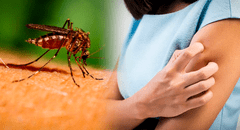 ¿Cómo quitar la picazón de un mosquito con remedios caseros?