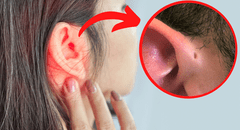 ¿Por qué algunas personas tienen un orificio en la oreja y otras no?