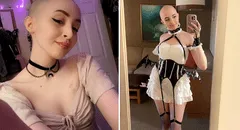 OnlyFans: joven usa ganancias para tratarse contra el cáncer y dice que sus fans "aman su look calvo"