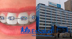 ¿Puedo ponerme brackets con el seguro de EsSalud?