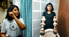 El increíble caso de la mujer que recibió un trasplante de brazos de un hombre y su cuerpo logró adaptarlos