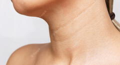 ¿Por qué aparecen líneas en el cuello y cómo atenuarlas?