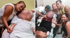 Gaziely Alves: la joven brasileña con hidrocefalia gigante que lleva 29 años luchando por su vida